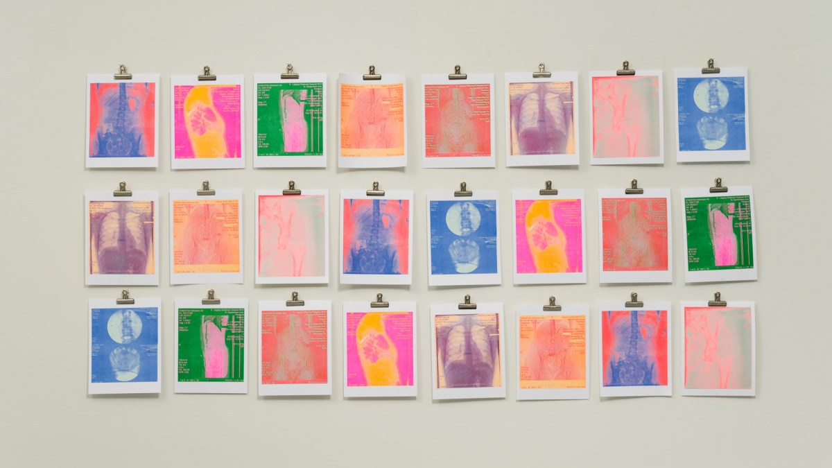 Loki Demarais, Medical Anomaly, 2024, risograph prints, 8.5 x11 inches each, image: Mario Gallucci